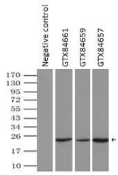 Anti-alpha B Crystallin antibody [6A9] used in Immunoprecipitation (IP). GTX84659