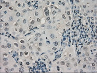 Anti-alpha B Crystallin antibody [3C2] used in IHC (Paraffin sections) (IHC-P). GTX84661