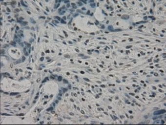 Anti-alpha B Crystallin antibody [3C2] used in IHC (Paraffin sections) (IHC-P). GTX84661