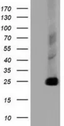 Anti-CLPP antibody [1D8] used in Western Blot (WB). GTX84679