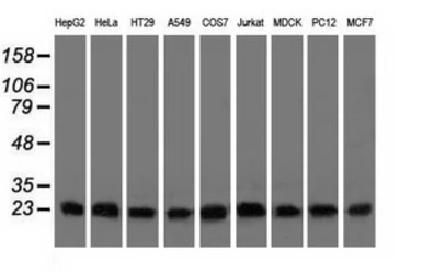 Anti-CLPP antibody [1D8] used in Western Blot (WB). GTX84679