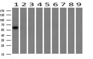 Anti-Chk2 antibody [2F4] used in Western Blot (WB). GTX84685