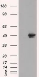 Anti-CUGBP1 antibody [5B8] used in Western Blot (WB). GTX84692