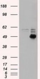 Anti-CD4 antibody [10B5] used in Western Blot (WB). GTX84720