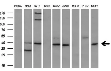 Anti-CD2 antibody [4E4] used in Western Blot (WB). GTX84724