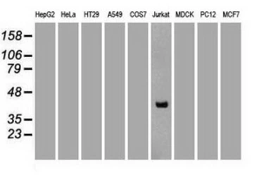 Anti-CD2 antibody [9D1] used in Western Blot (WB). GTX84725