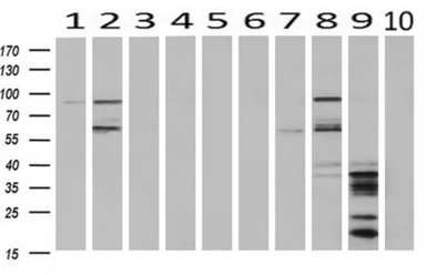 Anti-C17orf28 antibody [2F4] used in Western Blot (WB). GTX84750