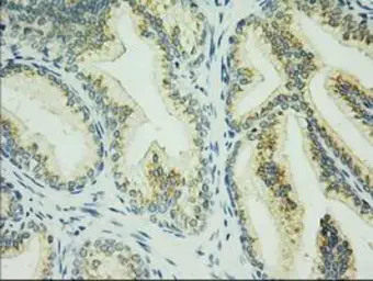 Anti-C17orf28 antibody [5C4] used in IHC (Paraffin sections) (IHC-P). GTX84754