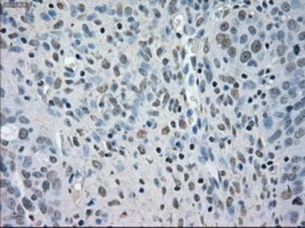 Anti-BUB1B antibody [11G2] used in IHC (Paraffin sections) (IHC-P). GTX84768