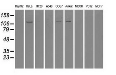Anti-BUB1B antibody [11G2] used in Western Blot (WB). GTX84768