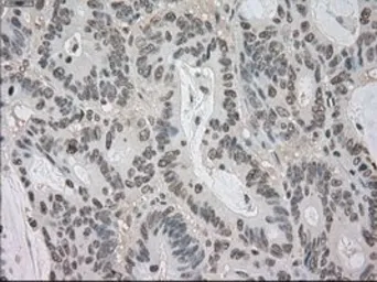 Anti-BUB1B antibody [5D9] used in IHC (Paraffin sections) (IHC-P). GTX84771