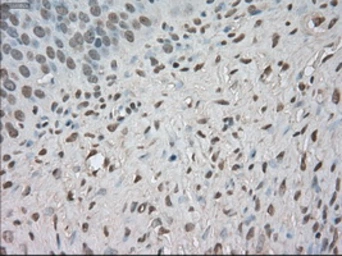 Anti-BUB1B antibody [5D9] used in IHC (Paraffin sections) (IHC-P). GTX84771