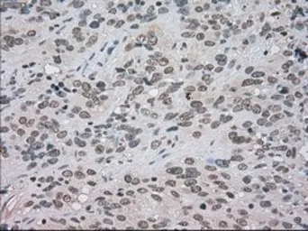 Anti-BUB1B antibody [5D9] used in IHC (Paraffin sections) (IHC-P). GTX84771