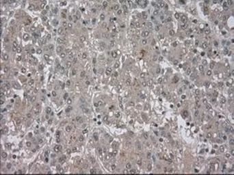Anti-BUB1B antibody [5D9] used in IHC (Paraffin sections) (IHC-P). GTX84771