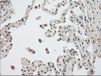 Anti-BUB1B antibody [5D9] used in IHC (Paraffin sections) (IHC-P). GTX84771