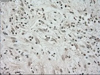 Anti-BUB1B antibody [5D9] used in IHC (Paraffin sections) (IHC-P). GTX84771