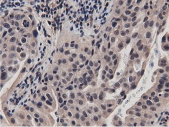 Anti-BTN1A1 antibody [7B5] used in IHC (Paraffin sections) (IHC-P). GTX84781