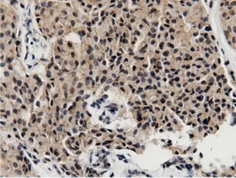 Anti-BTN1A1 antibody [7B5] used in IHC (Paraffin sections) (IHC-P). GTX84781