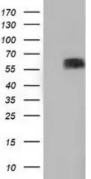 Anti-BTN1A1 antibody [7B5] used in Western Blot (WB). GTX84781