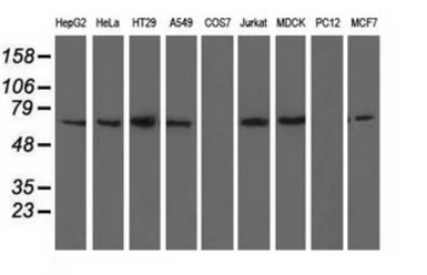 Anti-BTN1A1 antibody [7B5] used in Western Blot (WB). GTX84781