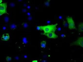 Anti-BTK antibody [10E10] used in Immunocytochemistry/ Immunofluorescence (ICC/IF). GTX84785
