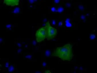 Anti-BTK antibody [12H4] used in Immunocytochemistry/ Immunofluorescence (ICC/IF). GTX84792