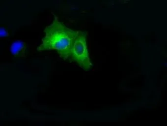 Anti-B-Raf antibody [1E2] used in Immunocytochemistry/ Immunofluorescence (ICC/IF). GTX84806