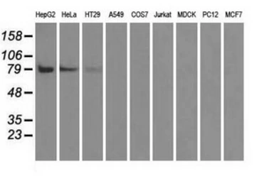Anti-B-Raf antibody [1E2] used in Western Blot (WB). GTX84806