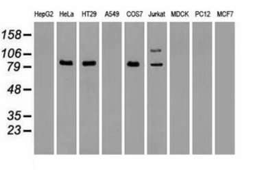 Anti-B-Raf antibody [4B2] used in Western Blot (WB). GTX84814