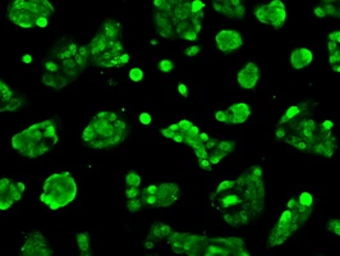 Anti-Livin antibody [1B10] used in Immunocytochemistry/ Immunofluorescence (ICC/IF). GTX84822