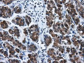 Anti-Livin antibody [1D12] used in IHC (Paraffin sections) (IHC-P). GTX84823