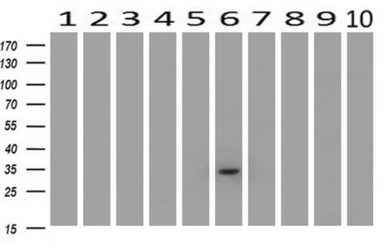 Anti-Livin antibody [1D12] used in Western Blot (WB). GTX84823