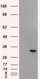 Anti-Livin antibody [1D12] used in Western Blot (WB). GTX84823