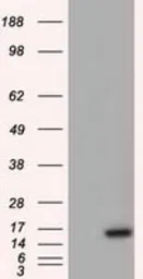 Anti-Survivin antibody [2D9] used in Western Blot (WB). GTX84824