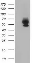 Anti-Bestrophin 3 antibody [3B11] used in Western Blot (WB). GTX84829
