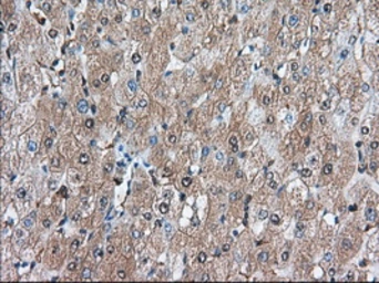 Anti-BDH2 antibody [4G4] used in IHC (Paraffin sections) (IHC-P). GTX84833