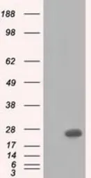 Anti-BDH2 antibody [4G4] used in Western Blot (WB). GTX84833