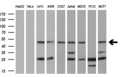 Anti-BAT1 antibody [2C5] used in Western Blot (WB). GTX84837