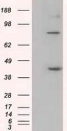 Anti-BAT1 antibody [2C5] used in Western Blot (WB). GTX84837