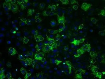 Anti-ATP5B antibody [5G2] used in Immunocytochemistry/ Immunofluorescence (ICC/IF). GTX84841