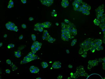 Anti-ATP5B antibody [5G2] used in Immunocytochemistry/ Immunofluorescence (ICC/IF). GTX84841