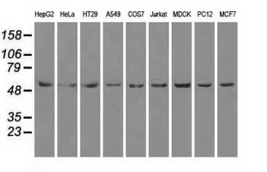 Anti-ATP5B antibody [5G2] used in Western Blot (WB). GTX84841