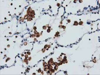 Anti-ARHGAP25 antibody [12E6] used in IHC (Paraffin sections) (IHC-P). GTX84868