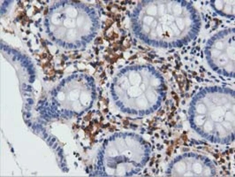 Anti-ARHGAP25 antibody [12E6] used in IHC (Paraffin sections) (IHC-P). GTX84868