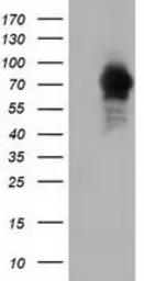 Anti-ARHGAP25 antibody [12E6] used in Western Blot (WB). GTX84868