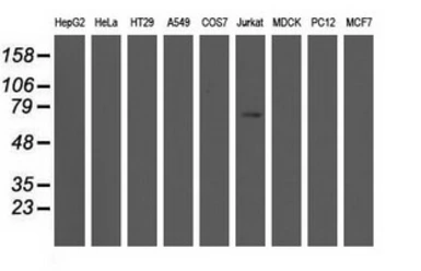 Anti-ARHGAP25 antibody [12E6] used in Western Blot (WB). GTX84868