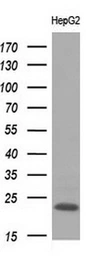 Anti-Apolipoprotein M antibody [3H3] used in Western Blot (WB). GTX84882