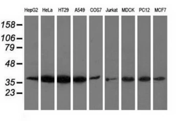 Anti-Annexin III antibody [1A9] used in Western Blot (WB). GTX84883