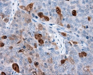 Anti-Annexin A1 antibody [3A8] used in IHC (Paraffin sections) (IHC-P). GTX84886