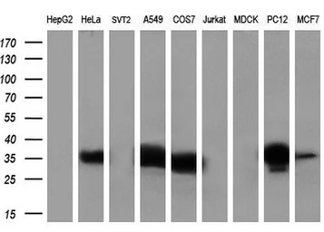 Anti-Annexin A1 antibody [3A8] used in Western Blot (WB). GTX84886